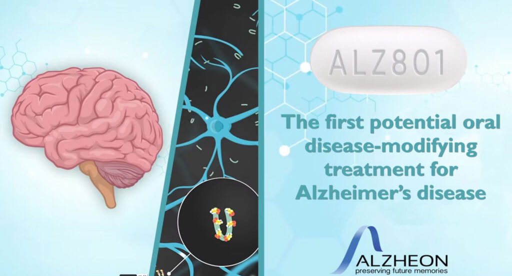 New Alzheimer's Clinical Trial How Does it Work? Triad Clinical Trials